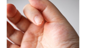 Tırnak Sağlığı ve Bakımı: İpuçları, Hastalıklar ve Doğal Çözümler